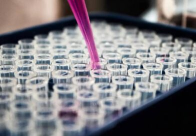 Pesquisas brasileiras avançam no diagnóstico de Alzheimer