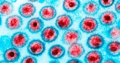 Paciente tem remissão do HIV após transplante de medula óssea do irmão Paciente tem remissão do HIV após transplante de medula óssea do irmão