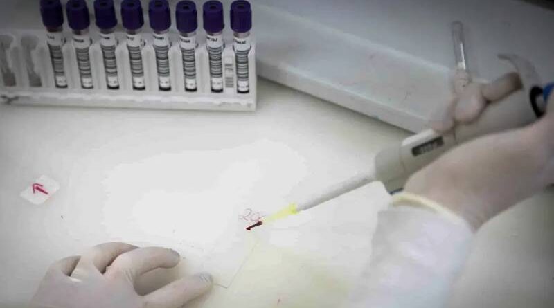 Paciente em SP com suspeita de ebola testa positivo para meningite Paciente em SP com suspeita de ebola testa positivo para meningite
